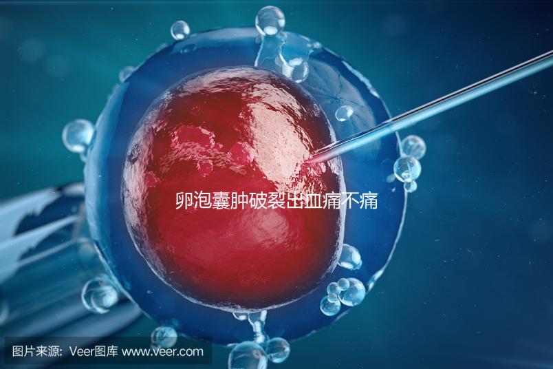 卵泡囊腫破裂出血痛不痛？經(jīng)歷過的姐妹們給出回應(yīng)