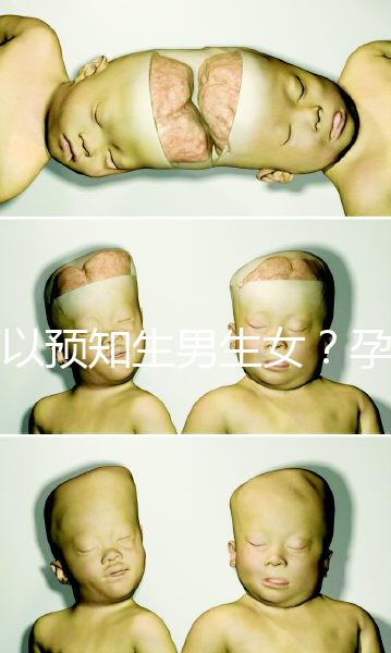 可以預知生男生女？孕婦夢見馬的胎夢解讀