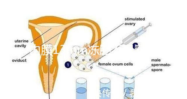 內(nèi)膜13mm凍胚不易著床要注意，移植與否看醫(yī)生怎么說