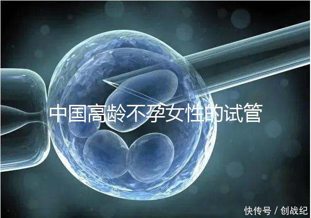 中國高齡不孕女性的試管嬰兒指南，8個(gè)方面5條推薦意見