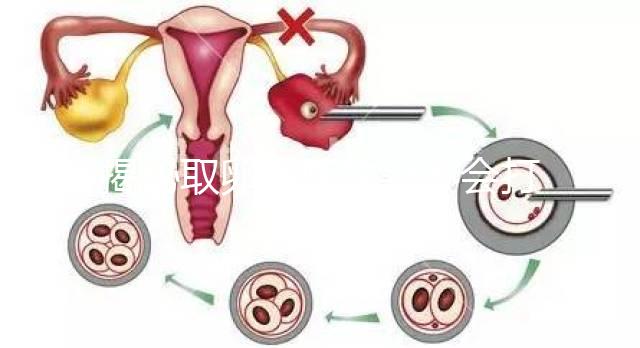 揭秘取卵后醫生會不會打電話問選幾代？這些問題會涉及到