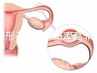 弓形子宮流產(chǎn)概率高非個例!罪魁禍首是這個原因