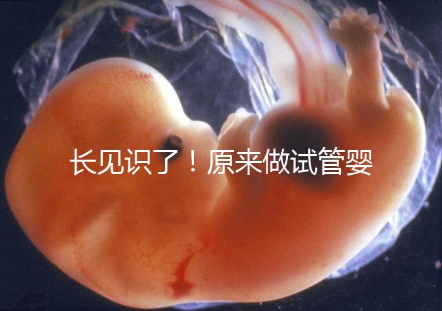 長(zhǎng)見(jiàn)識(shí)了！原來(lái)做試管嬰兒，精子是這樣被篩選出來(lái)的