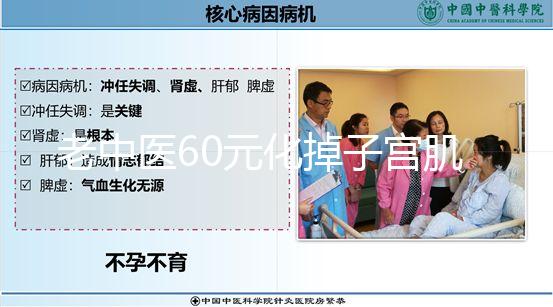 老中醫60元化掉子宮肌瘤偏方一覽，三棱效果怎樣用了就造