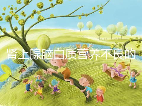 腎上腺腦白質營養不良的遺傳概率,如何避免遺傳?