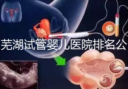 蕪湖試管嬰兒醫(yī)院排名公開(kāi),弋磯山醫(yī)院、蕪湖二院獲好評(píng)
