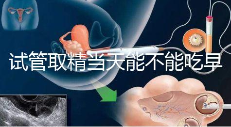 試管取精當(dāng)天能不能吃早餐喝水的答案來咯咯,好不好一看就知道了?