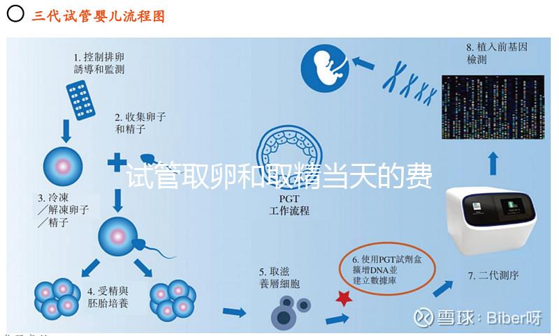 試管取卵和取精當(dāng)天的費用明細(xì)表,大概多少錢一清二楚