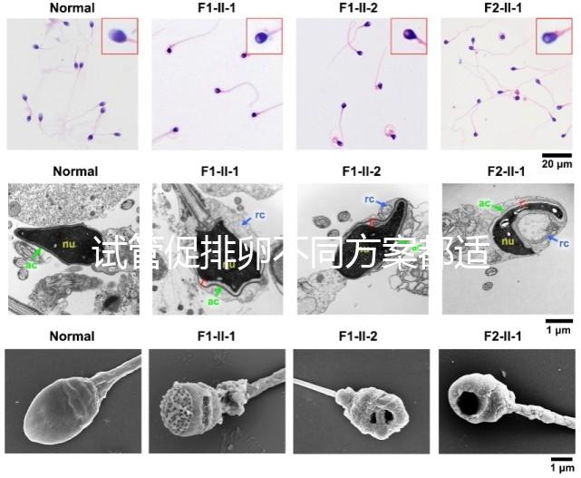 試管促排卵不同方案都適合哪些人？如何監(jiān)測(cè)排卵？