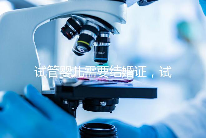 試管嬰兒需要結(jié)婚證,試管嬰兒是不是一定要結(jié)婚證