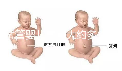 試管嬰兒費用大約多少2021年:國內試管之(10)額外可能需要費用: