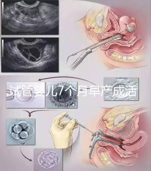 試管嬰兒7個月早產(chǎn)成活率高達80%！能不能要看身體狀況