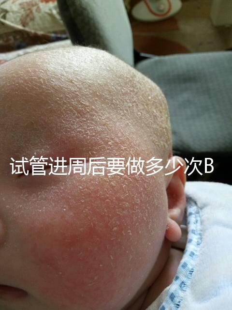 試管進周后要做多少次B超？需要檢查什么？進來看看