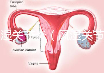 風濕關(guān)節(jié)炎(風濕關(guān)節(jié)炎的癥狀有哪些)