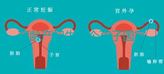 高齡產(chǎn)婦生八個孩子國家有補助？有沒有違法才是關鍵